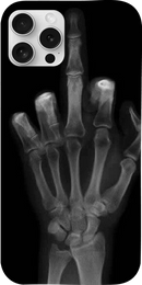 Cover radiografia