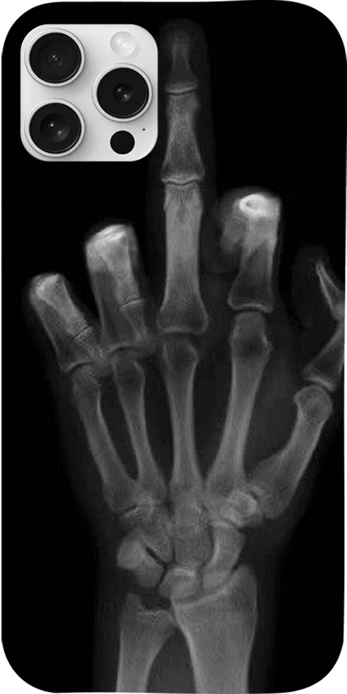 Cover radiografia - Xiaomi